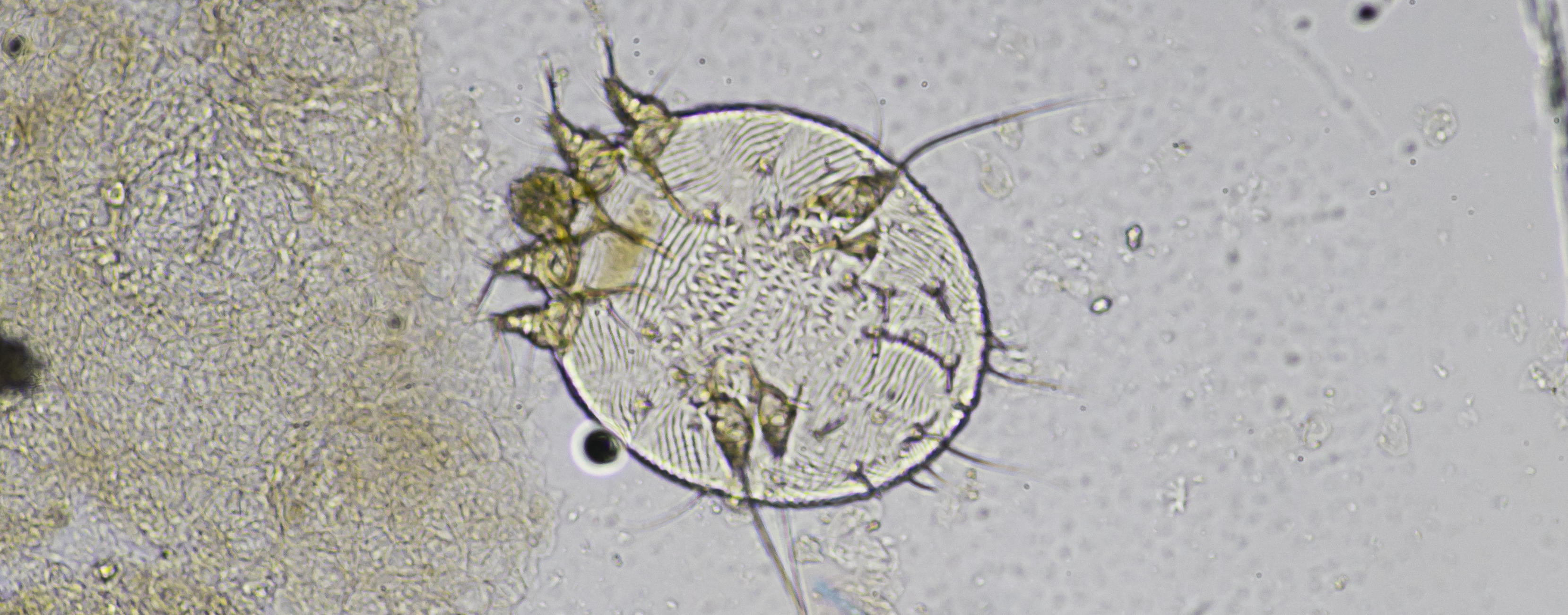 чесоточный клещ под микроскопом