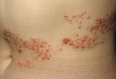 Фотографии заболеваний кожи, дополнительные пояснения