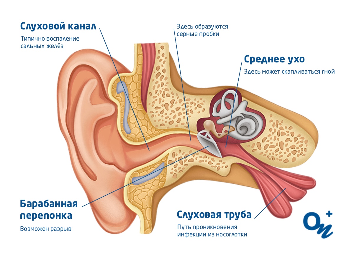 Почему возникает заложенность ушей при насморке