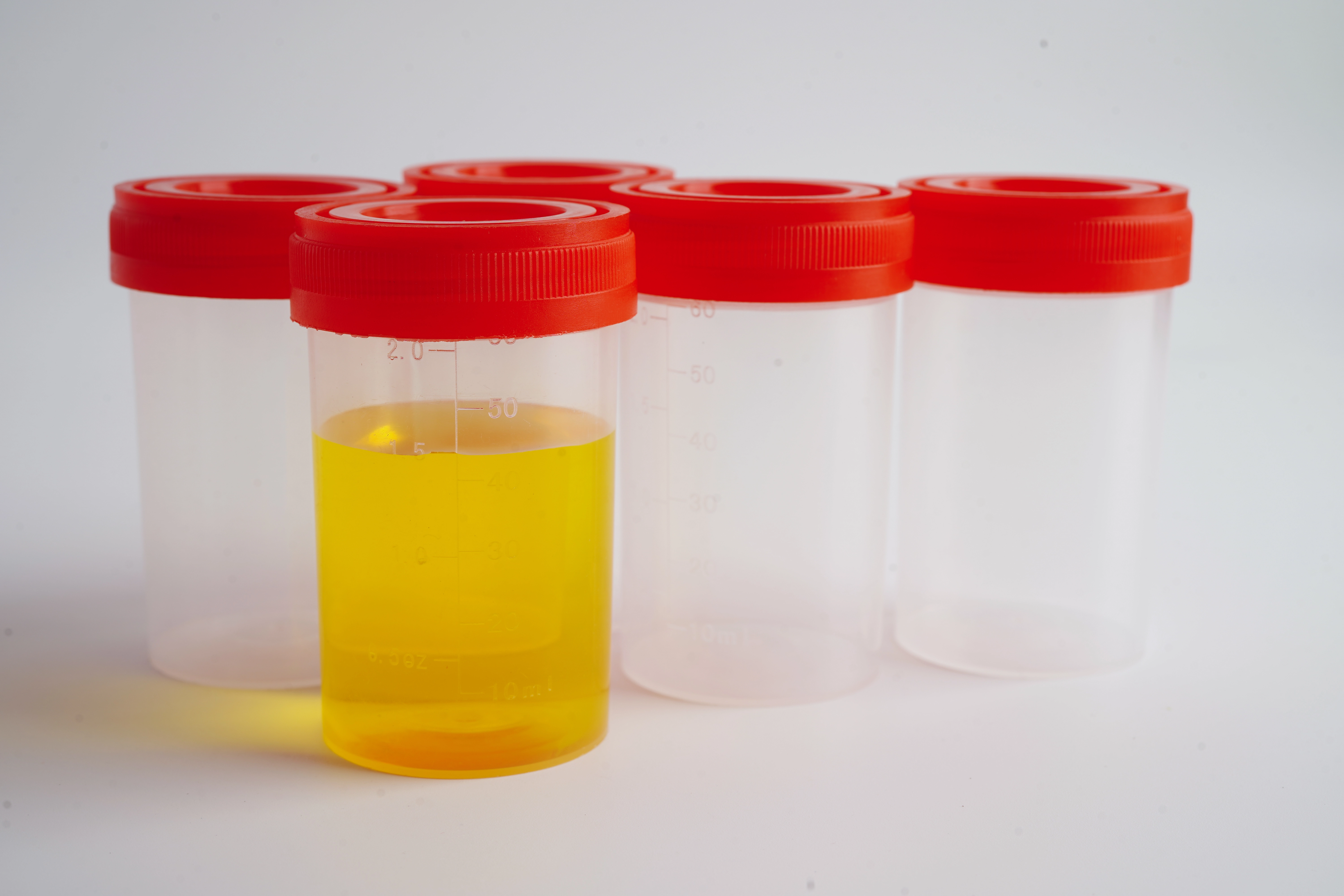 Уринотерапія — чи корисно пити сечу? Що кажуть дослідження