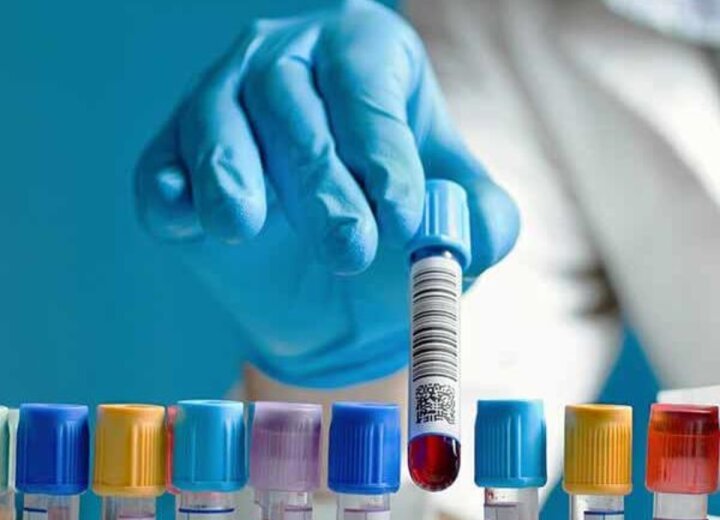 Норми та відхилення аналізу крові на онкомаркери