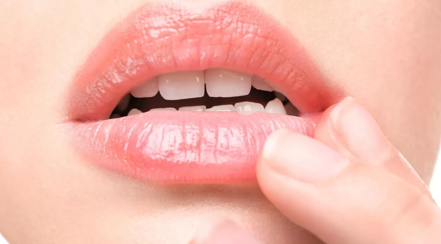 Как вылечить заеды в уголках рта (угловой хейлит)?