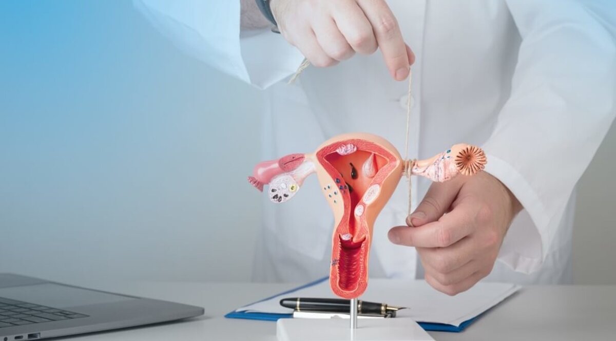 Кому підійде перев'язка маткових труб як метод контрацепції?