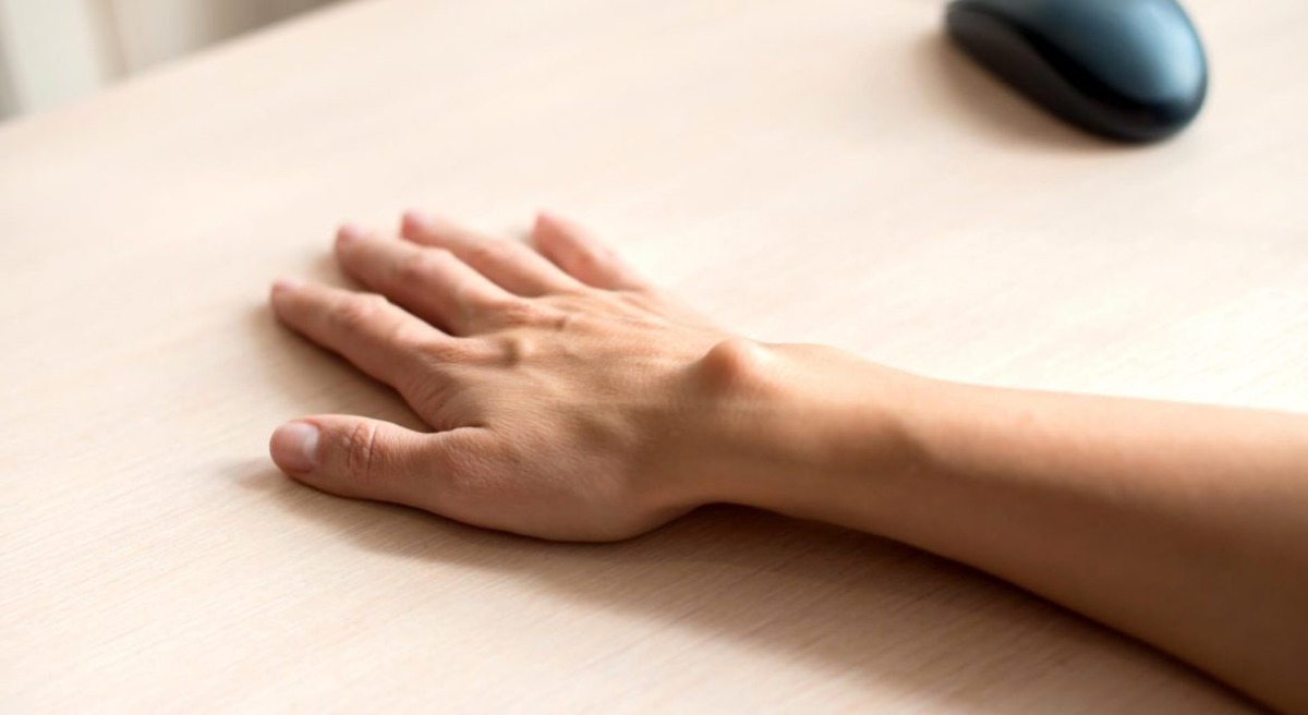 Как распознать гигрому и как от нее избавиться?