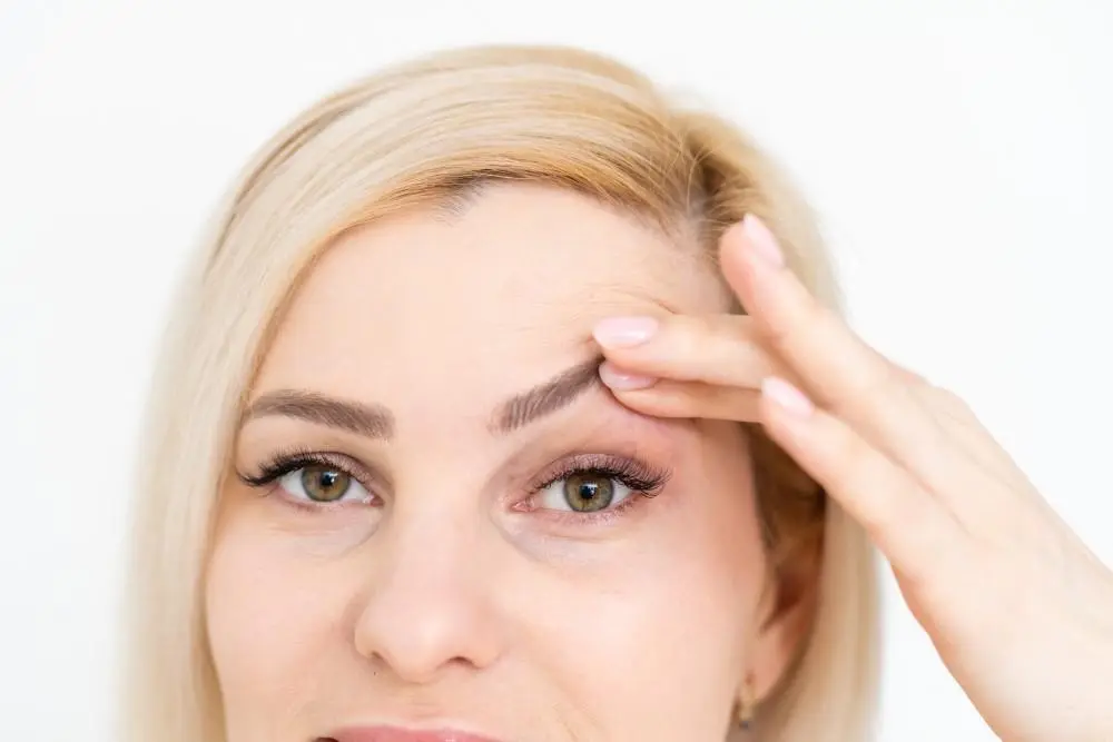 Як прибрати птоз (опущення) верхньої повіки?