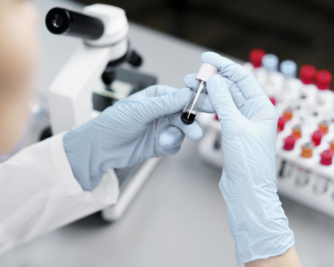 Что показывает липидограмма и когда ее нужно делать?