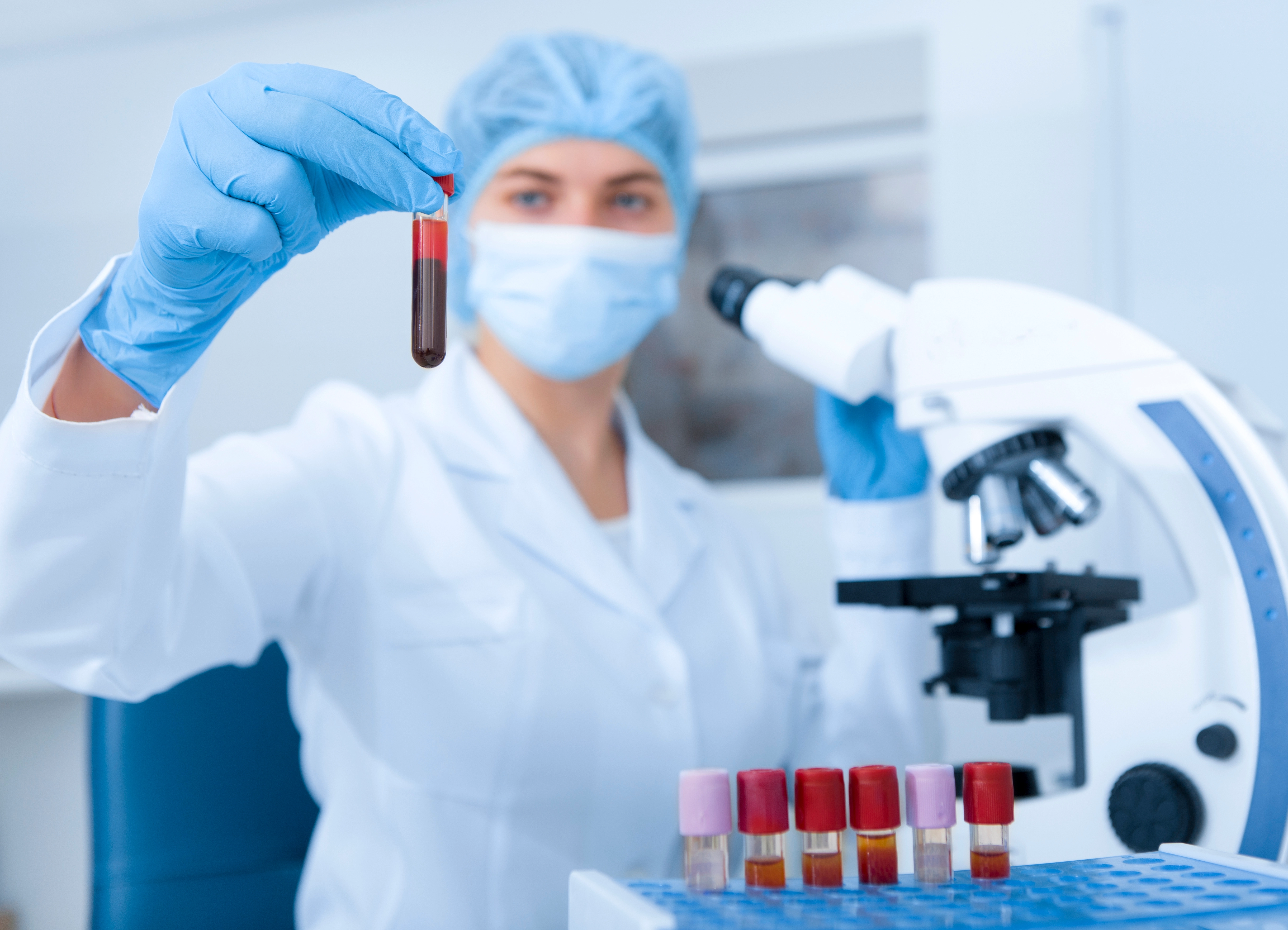 Що таке імуноглобулін, які причини підвищення та способи зниження?