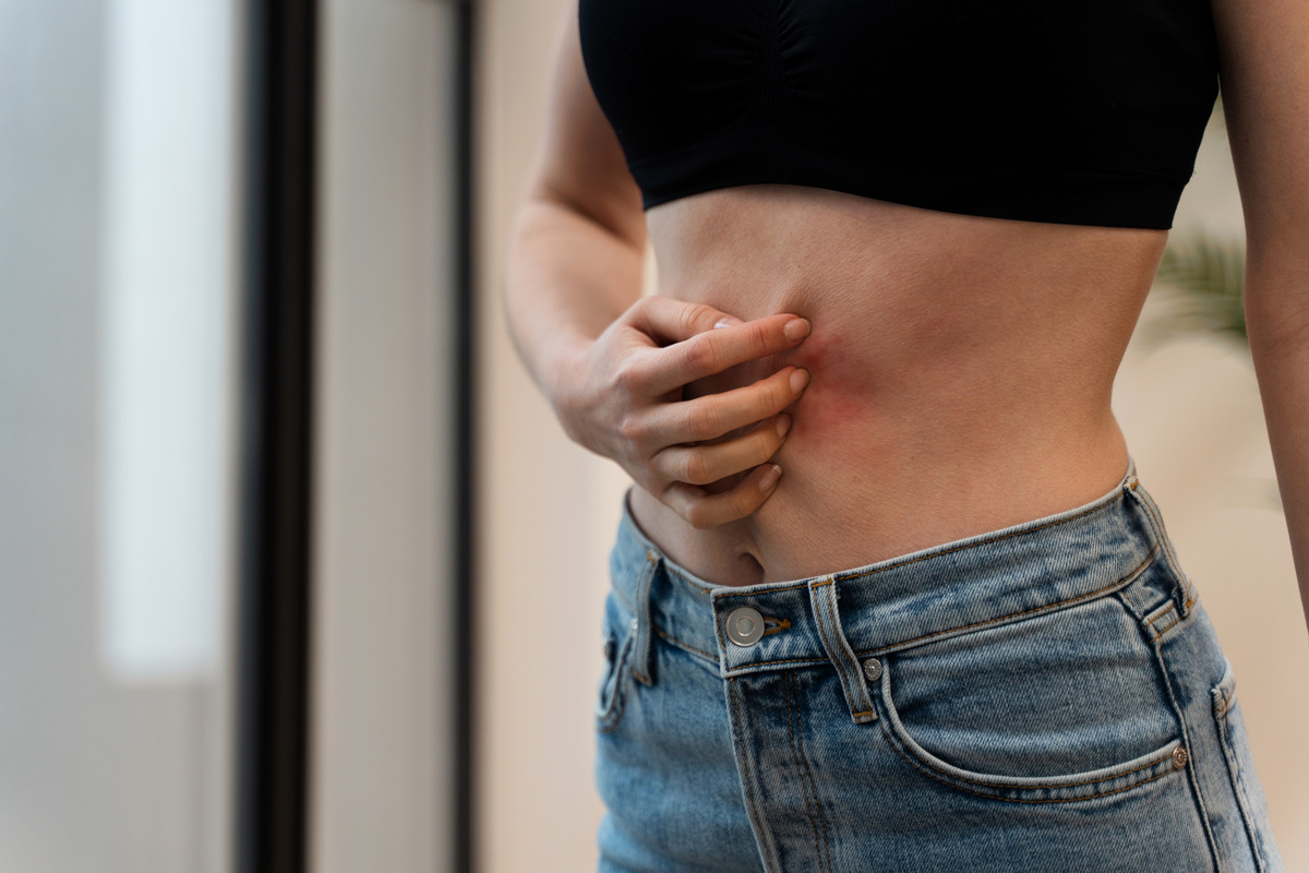 Что такое белая линия живота и как лечат грыжу белой линии живота?