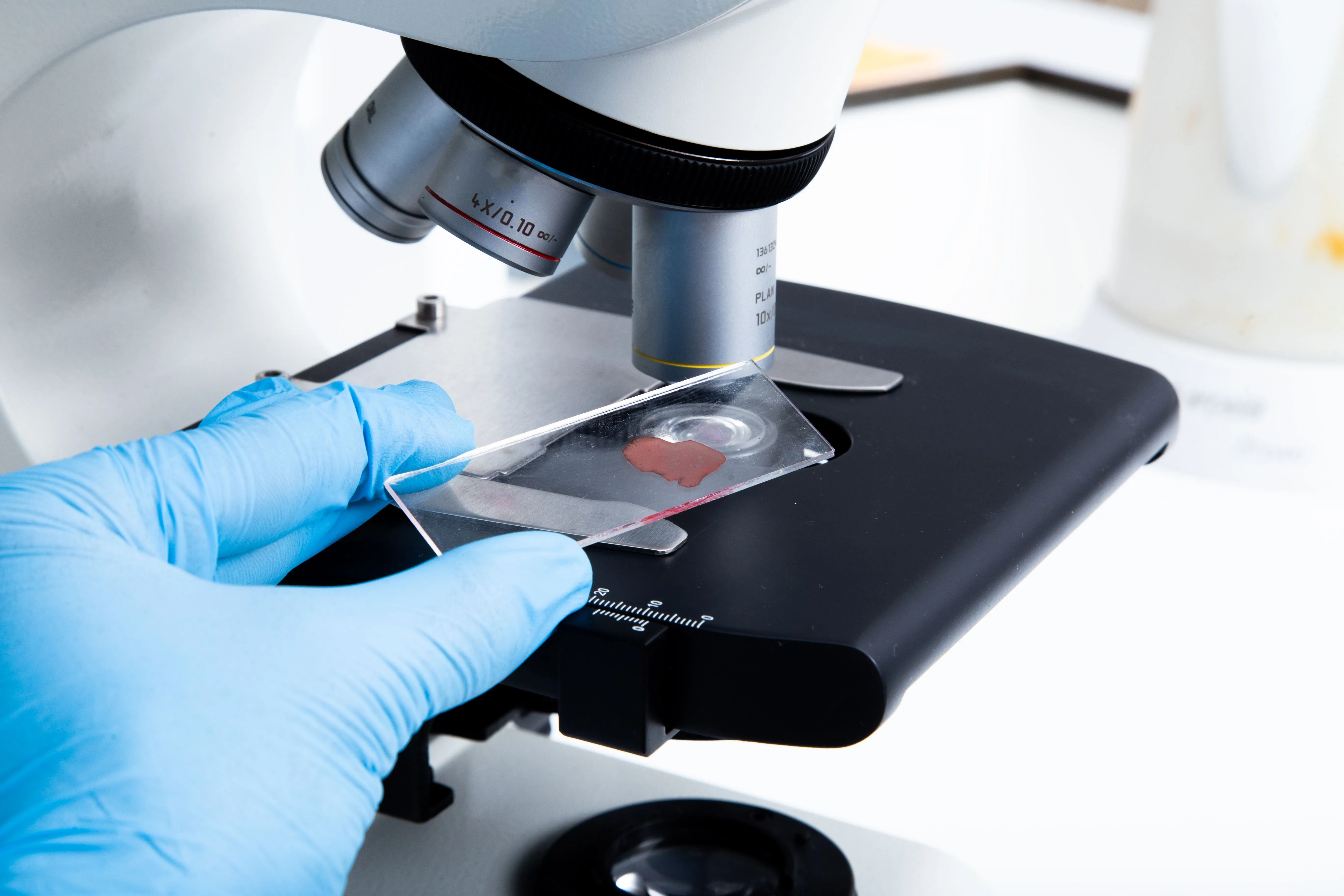 Фолликулостимулирующий гормон (ФСГ): норма и отклонения