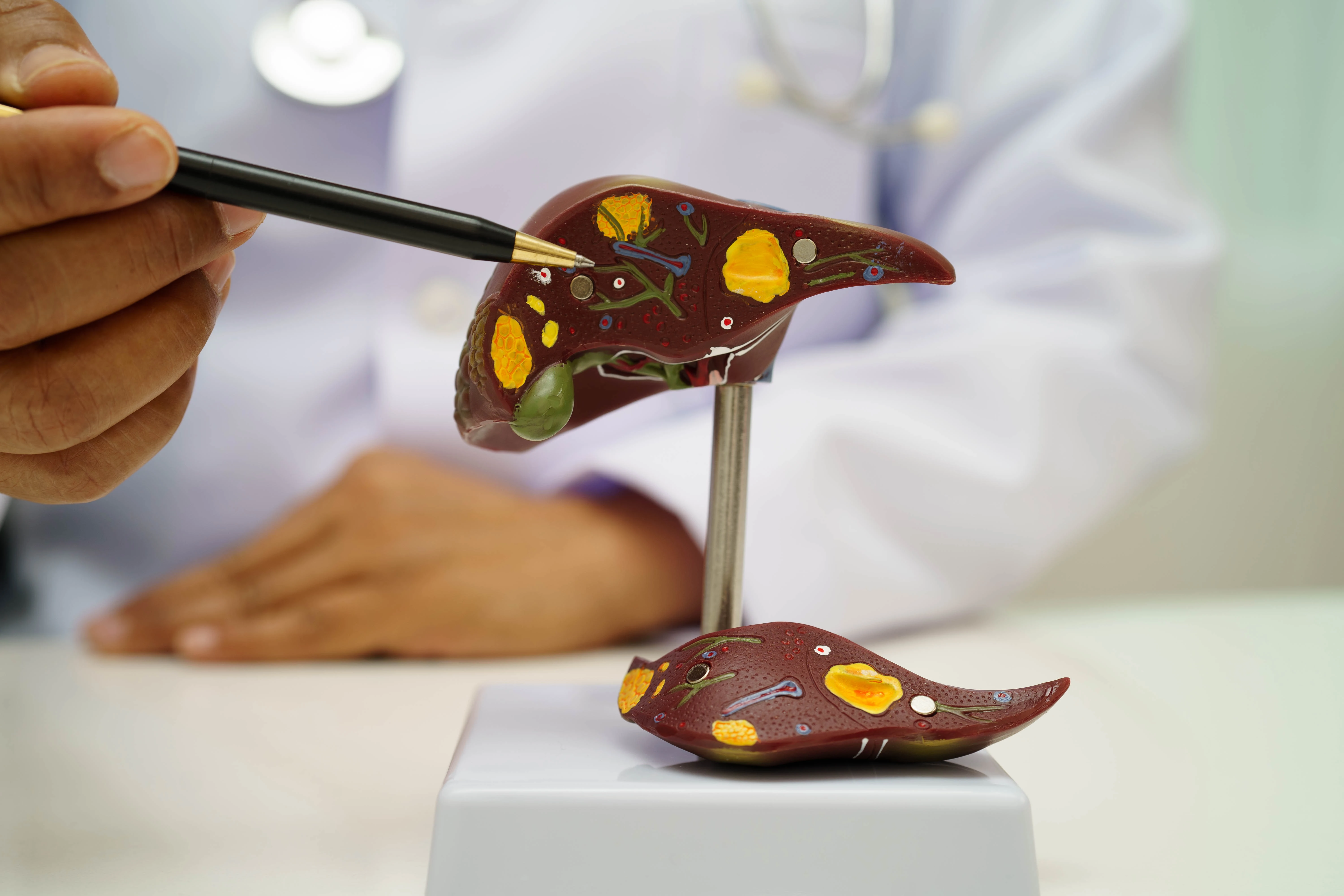 Як лікувати хронічний холецистит?