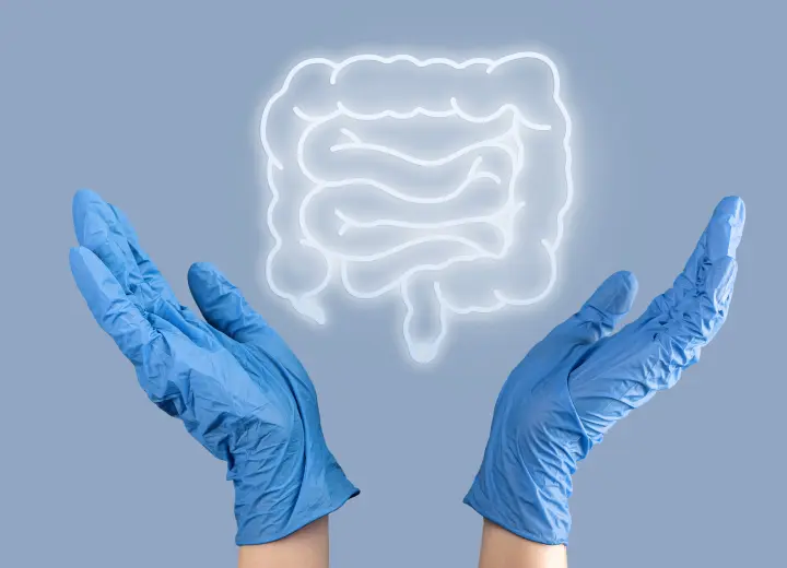 Поліпи в кишківнику. Коли необхідне видалення та як воно проходить?