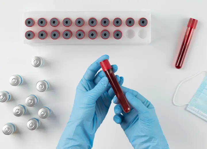 Антистрептолизин: норма и отклонения