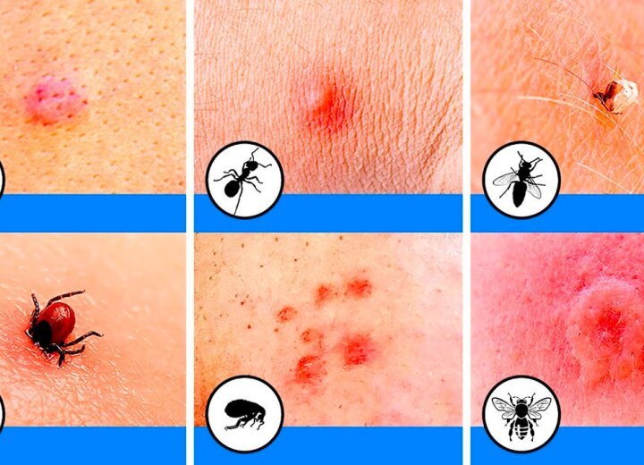 Опасные насекомые и их укусы