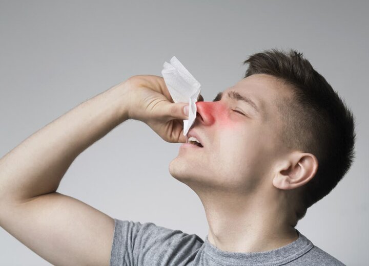 Як зупинити кров із носа?