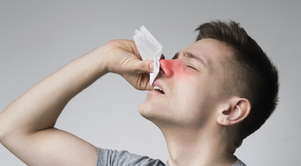 Как остановить кровь из носа?