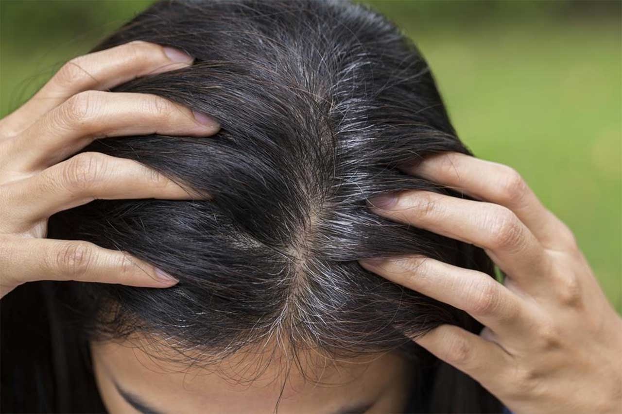 Седина волос: причины и лечение