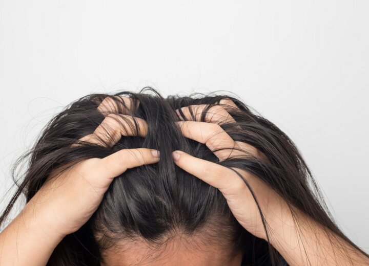 6 причин свербіння голови