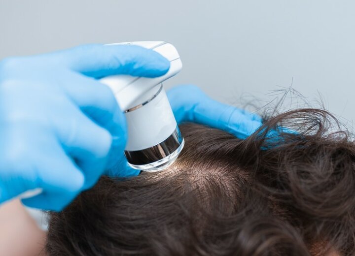 Трихоскопія – перший крок у лікуванні волосся та шкіри голови