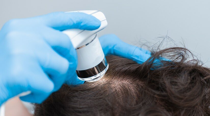 Трихоскопия - первый шаг в лечении волос и кожи головы