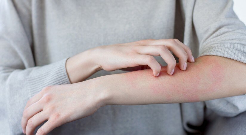 Які шкірні захворювання можуть з'явитися в міжсезоння?