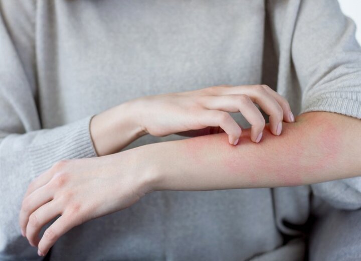 Які шкірні захворювання можуть з'явитися в міжсезоння?