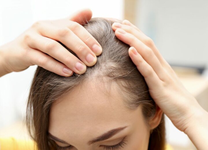 Які причини випадання волосся і як його зупинити?