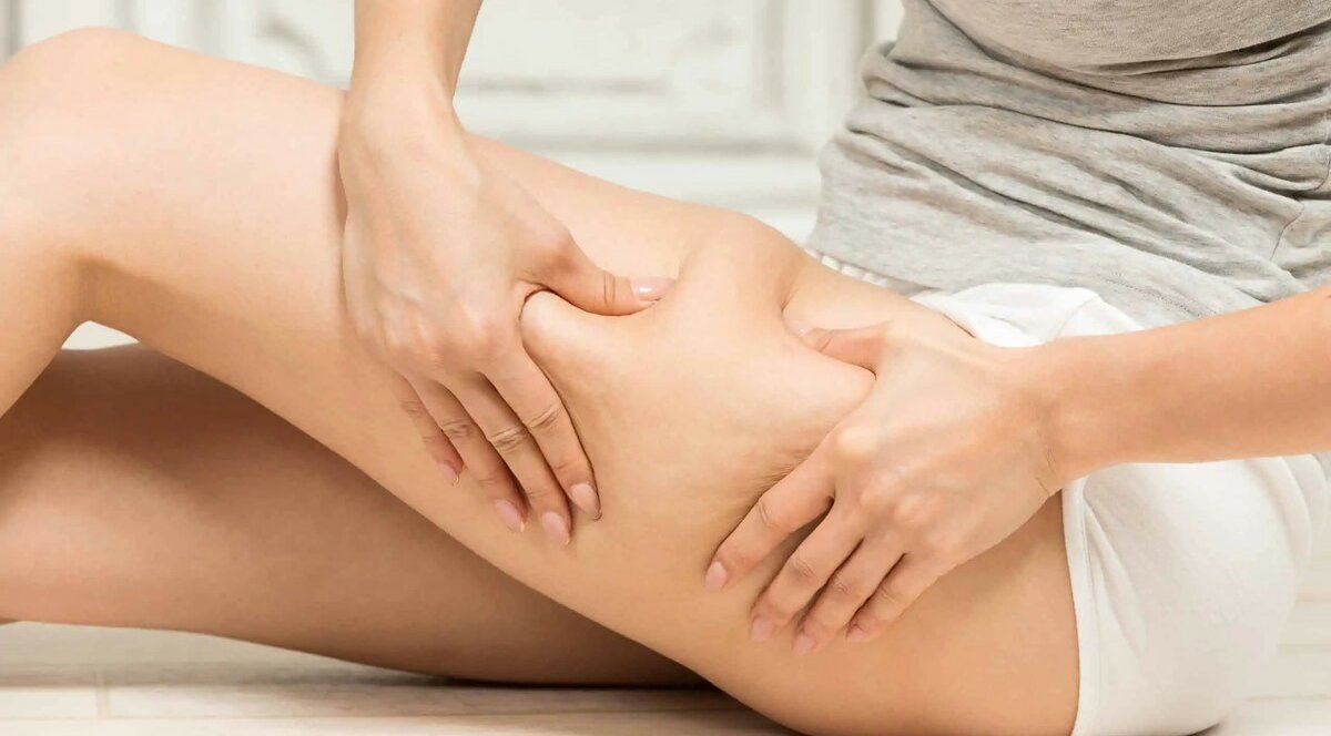 Антицелюлітний масаж: як його роблять і коли призначають?