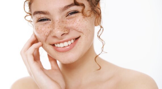Что такое веснушки и почему они появляются — блог медицинского центра ...