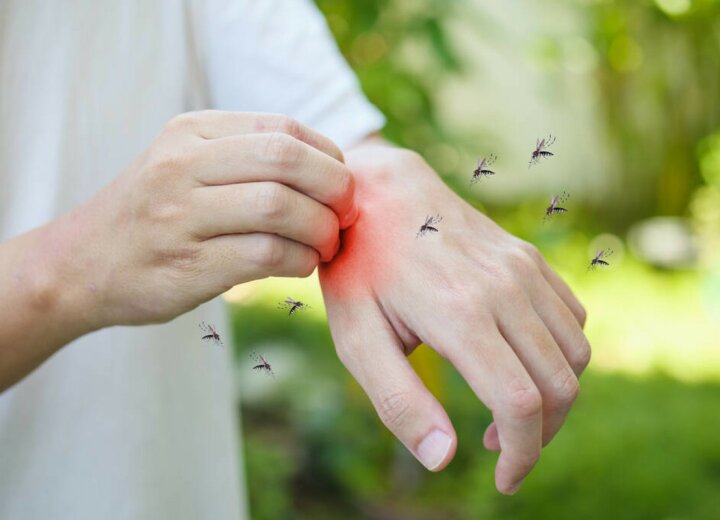 Чем можно заразиться от укуса комара и насколько это опасно?