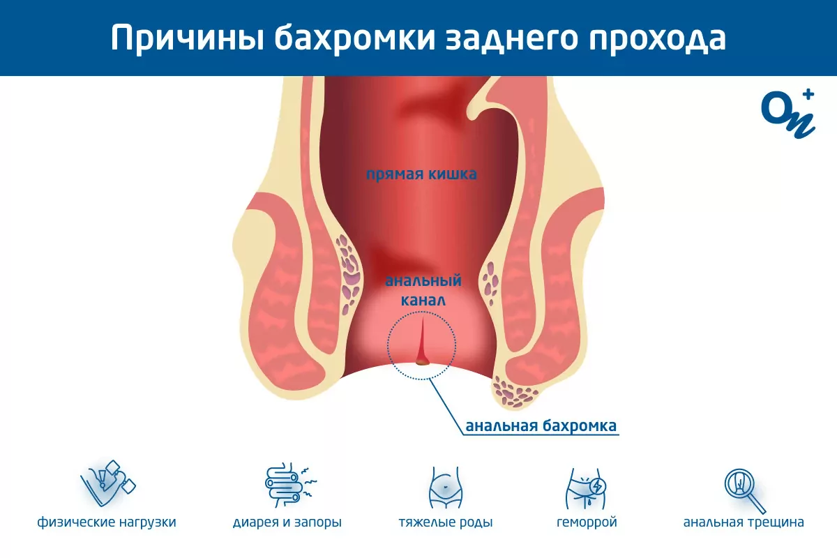 Женская интимная пластика