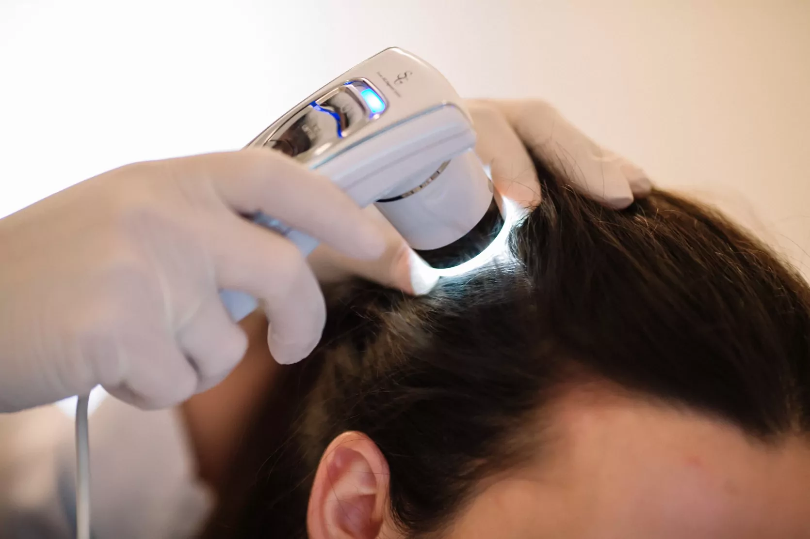 трихоскоп для диагностики нейродермита волосистой части головы в медицинском центре ОН Клиник Одесса