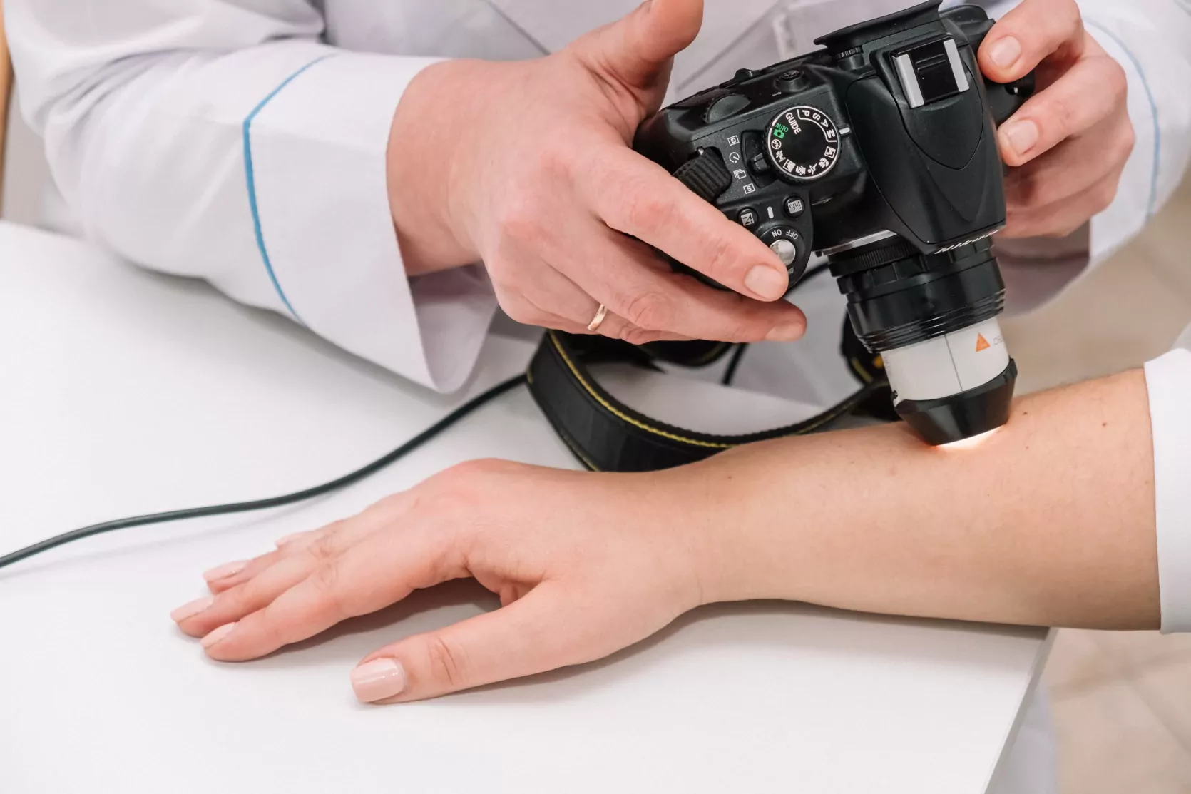 дерматоскоп для діагностики новоутворень на шкірі в медичному центрі ОН Клінік Ужгород