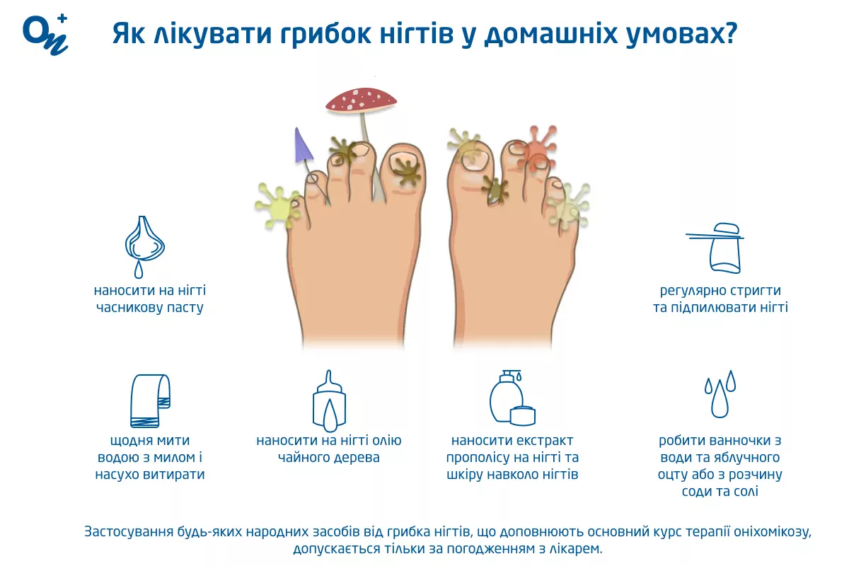 Як лікувати грибок нігтів у домашніх умовах?