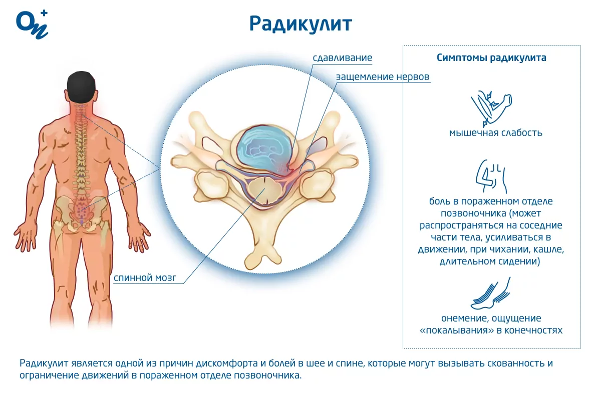 Лечебная физкультура для поясничного отдела позвоночника. Научный раздел клиники ИАКИ