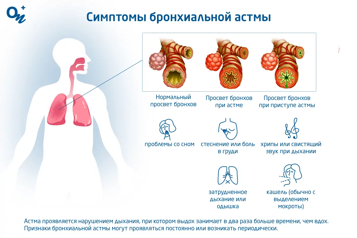 Симптомы бронхиальной астмы