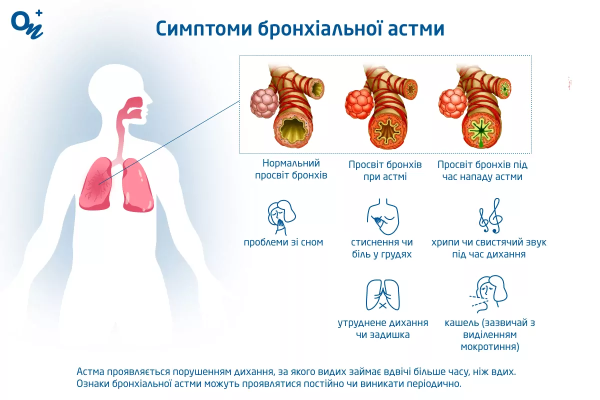 Симптоми бронхіальної астми