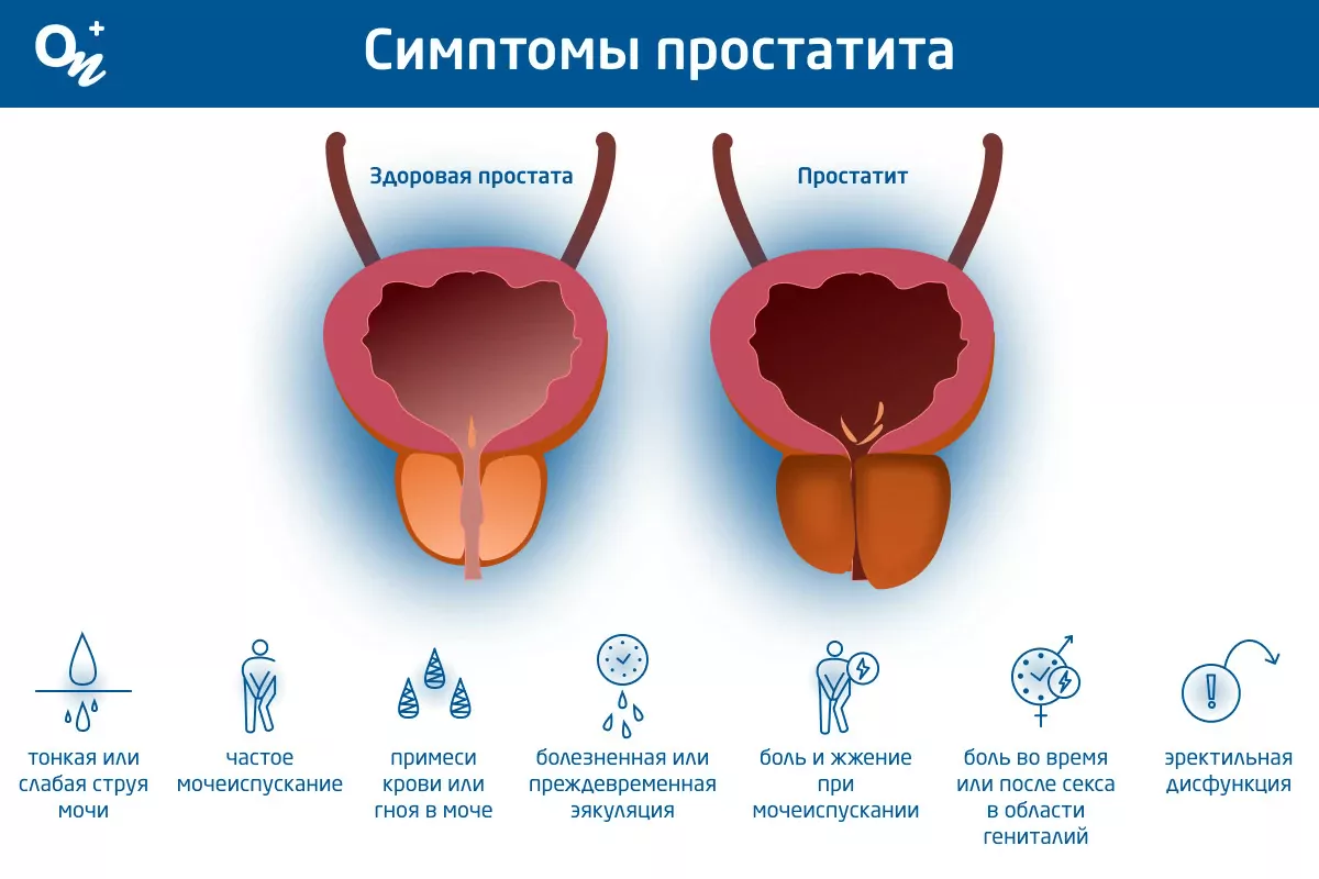 Нерегулярный секс вреден для здоровья