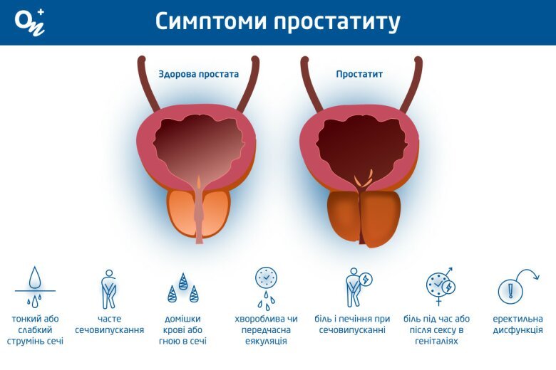 Где простата у мужчин фото