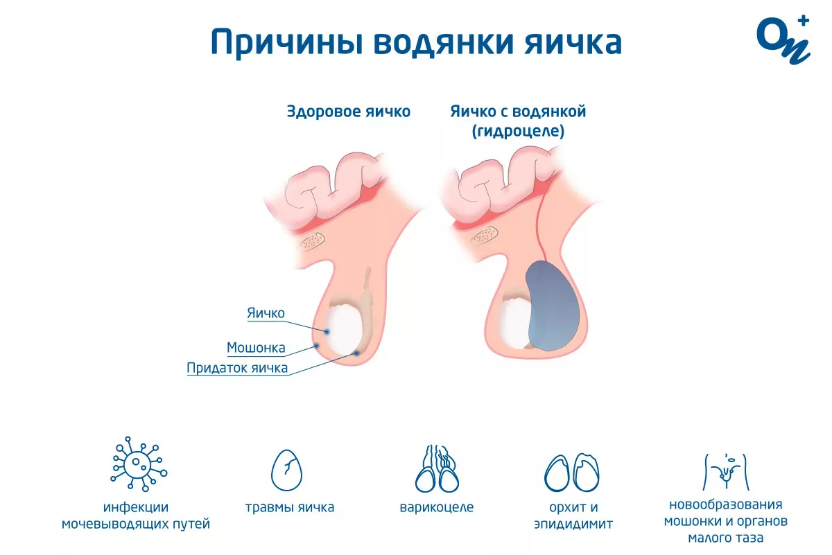 Вопрос урологу №16145