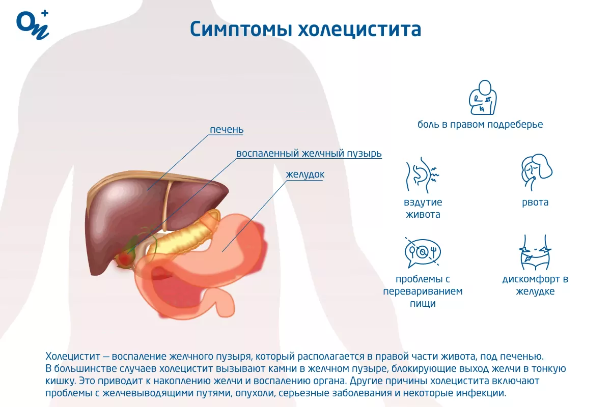 Холецистит - причины, факторы возникновения, симптомы и способы лечения холецистита