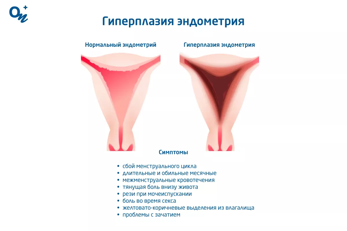 Выделения у женщин