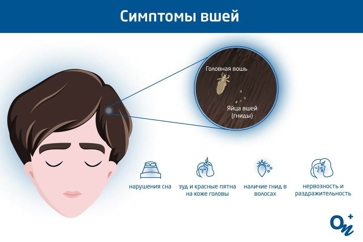 Симптомы вшей