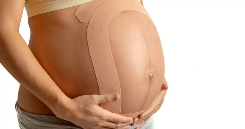 кинезиотейпы для беременных