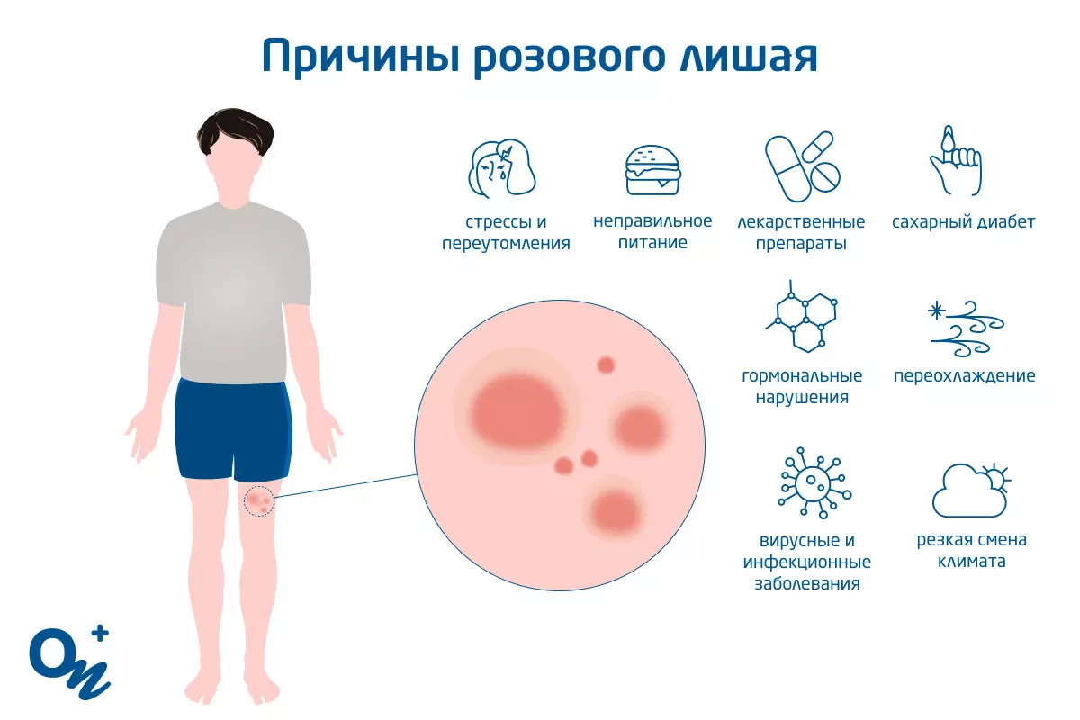 Установка внутриматочной спирали у гинеколога – цена в Санкт-Петербурге | Альтермед