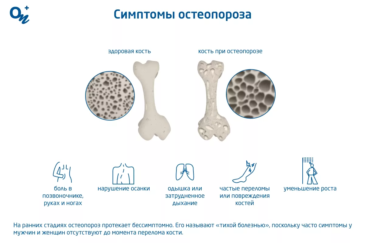 Как очистить суставы от вредных отложений?