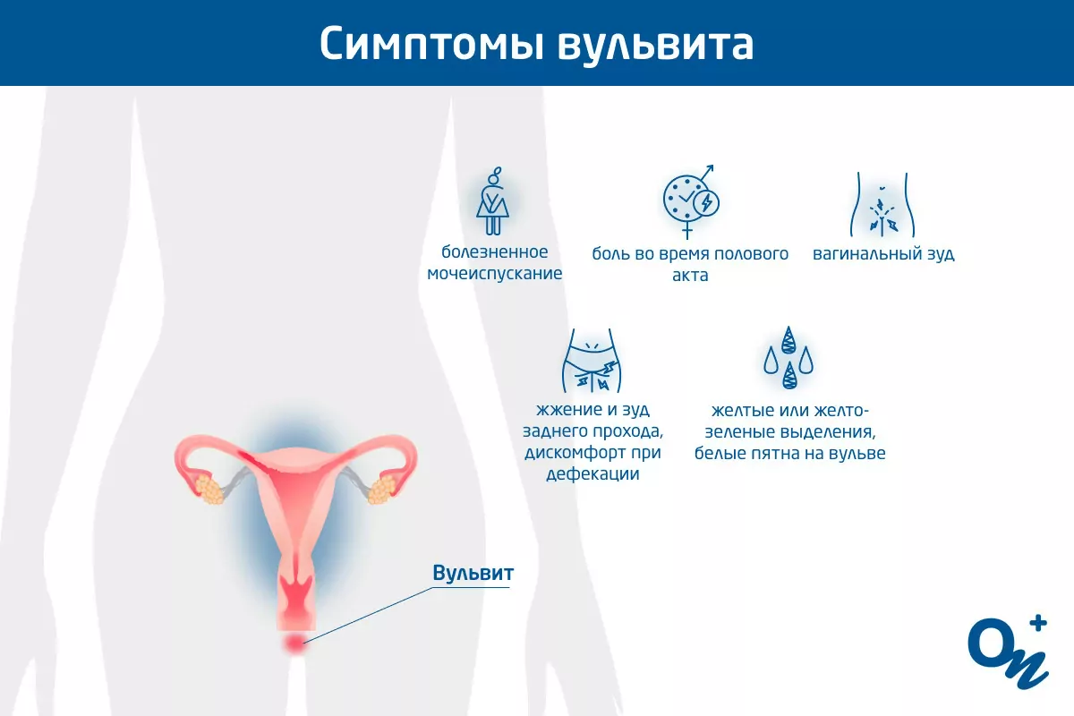 Зуд и жжение во влагалище: причины, симптомы и лечение