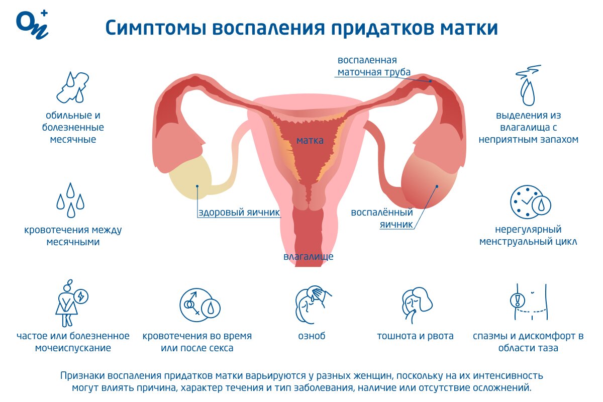 Воспаление влагалища: симптомы причины и лечение