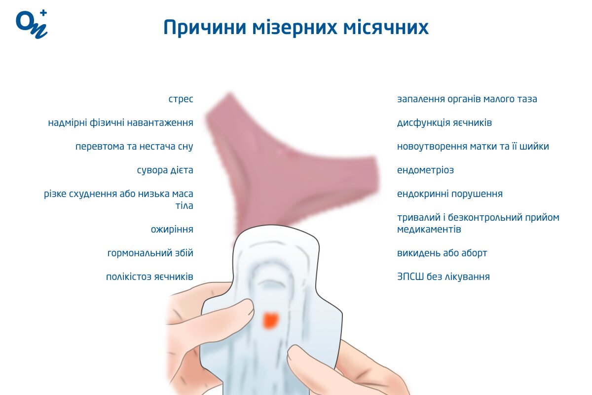 Чому виникають мізерні місячні — блог медичного центру ОН Клінік