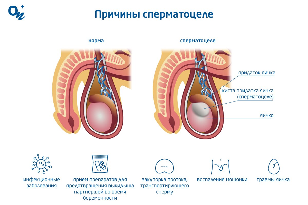 Как и где образуется сперма у мужчин