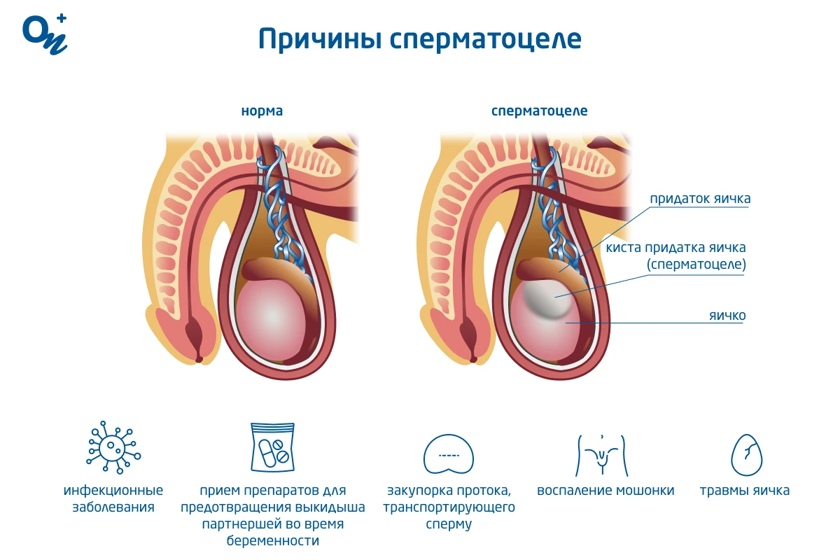 Боль в мошонке после секса: как от нее избавиться?. Клиника оперативной урологии и андрологии